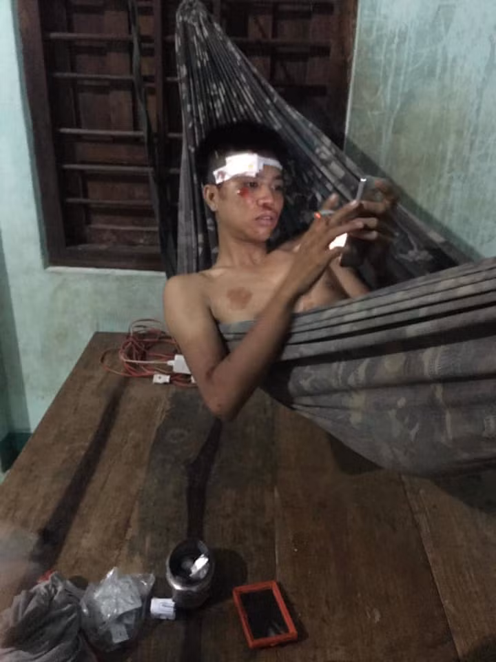 Hai thanh niên bị ngã và xước nhiều chỗ trên mặt, trên thân thể. Đây là cái kết mặc dù đã được cảnh báo từ trước nhưng họ vẫn làm ngơ.