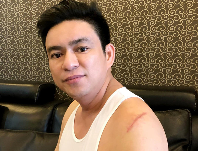 Một vết thương trên vai bác sĩ Chiêm Quốc Thái. Ảnh nhân vật cung cấp.