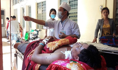 Dak Lak: Hai thanh nien bi thuong nang khi cua bom