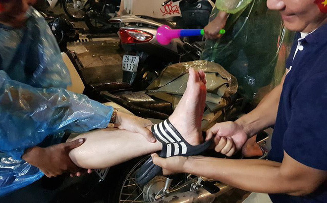 Thấy vậy, nhiều người xung quanh đã chạy tới giúp đỡ, giải thoát cổ chân cho chàng thanh niên. Và cũng với lý do này khiến nhiều người chỉ biết ôm bụng cười.