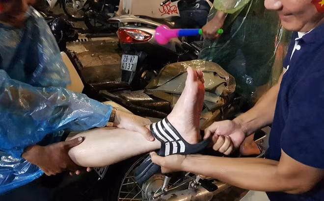 Thấy vậy, nhiều người xung quanh đã chạy tới giúp đỡ, giải thoát cổ chân cho chàng thanh niên. Và cũng với lý do này khiến nhiều người chỉ biết ôm bụng cười.