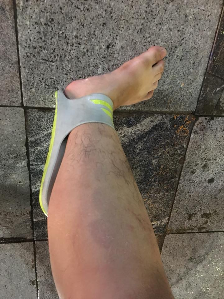 Bên cạnh đó, rất nhiều những hình ảnh tai nạn tương tự đã được dân mạng chia sẻ khiến mọi người chỉ biết ôm bụng cười.