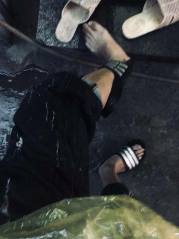 Tai nạn hy hữu này tưởng chừng như chỉ trẻ con mới gặp phải nhưng ai ngờ chính những bạn trẻ cũng có thể là nạn nhân.