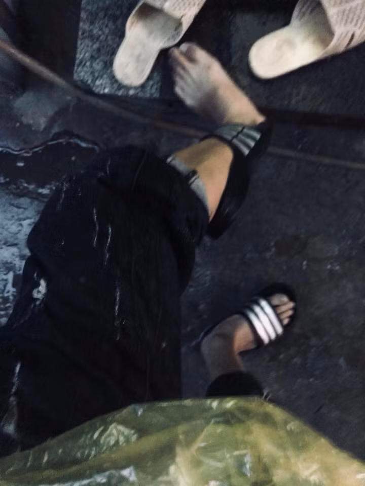 Tai nạn hy hữu này tưởng chừng như chỉ trẻ con mới gặp phải nhưng ai ngờ chính những bạn trẻ cũng có thể là nạn nhân.