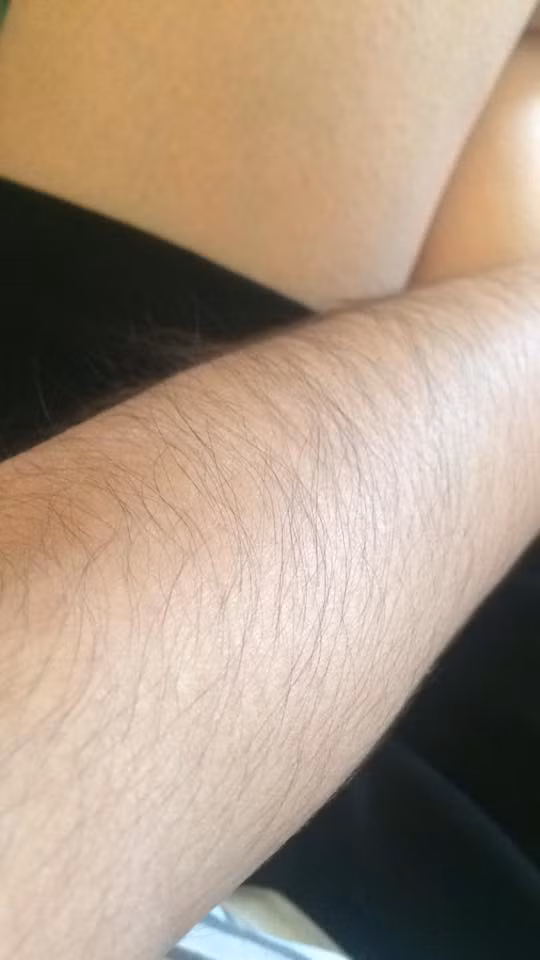 Một thiếu nữ hớn hở vào bình luận trào lưu nuôi lông tay rậm rằng: "Mẹ em hay bảo em là con đàn ông. Thế mà vào xem ảnh của mấy chị (không biết có phải là chị không nữa) xong thì em thấy mình tự tin hơn nhiều rồi!".