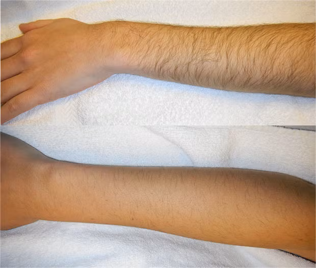 Một ứng viên khác cho biết sau khi tắm xong thì đống lông tay của cô sẽ rối hết vào nhau, còn cô gái khác thì tự nhận tay mình là quả kiwi thịt kéo dài.