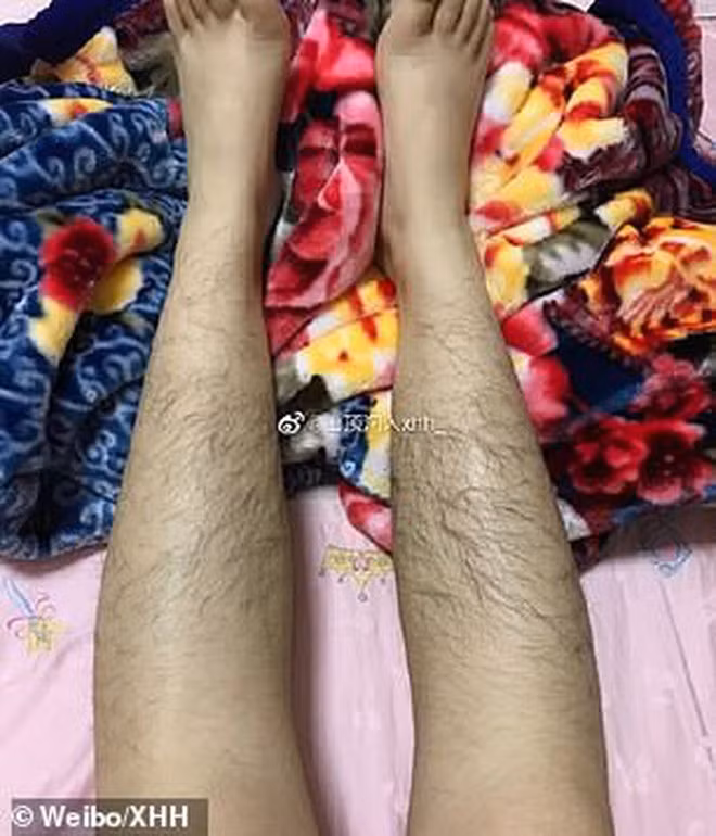 Shen Dian Tong Ji Lin - người khởi xướng trào lưu này, chia sẻ với tờ MailOnline rằng anh đã quyết định tổ chức cuộc thi selfie độc đáo này sau khi một fan hâm mộ gửi cho anh tấm hình của mình và than phiền về việc lông tay, lông chân mình quá dài.