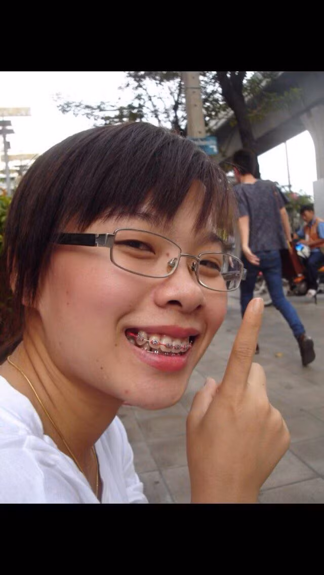 Sau khi không chịu nổi sự tự ti về sắc đẹp của mình, Stan bắt đầu nghĩ tới chuyện phẫu thuật thẩm mỹ để cải thiện nhan sắc. Đầu tiên cô bắt đầu với công đoạn nẹp răng để giải quyết vấn đề của của hàm răng vừa hô vừa xỉn của mình.