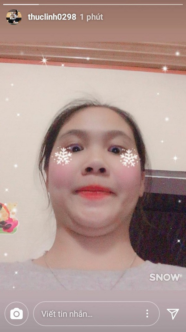 "Hai cằm" là nỗi sợ hãi mà bất cứ chị em nào cũng e dè, bởi họ lúc nào cũng chỉ mong sở hữu một gương mặt V-line, thon gọn. Tuy nhiên, không ít các cô gái không may mắn lại sở hữu đường nét bị coi là kém xinh này.