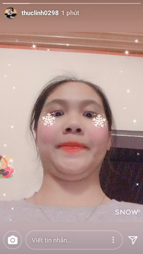 "Hai cằm" là nỗi sợ hãi mà bất cứ chị em nào cũng e dè, bởi họ lúc nào cũng chỉ mong sở hữu một gương mặt V-line, thon gọn. Tuy nhiên, không ít các cô gái không may mắn lại sở hữu đường nét bị coi là kém xinh này.