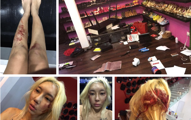 Những thương tích nghiêm trọng của nữ DJ.