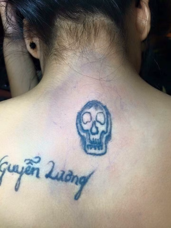 Đầu lâu xương sọ phiên phản lỗi.