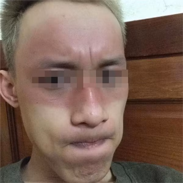 Khuôn mặt 2 màu da, thật đáng sợ của chàng trai dù đã cố che chắn nhưng không "xi nhê" với cái nắng đến rát mặt.