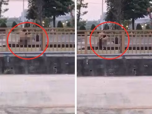 Nhuc mat cap doi vo tu 