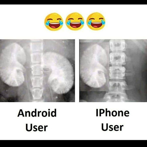 Cuộc so sánh hai quả thận của những người dùng Android và dùng Iphone. Với các fan của phần mềm Android thì những người dùng iPhone đều là người "bị hút máu" nhiều nhất.