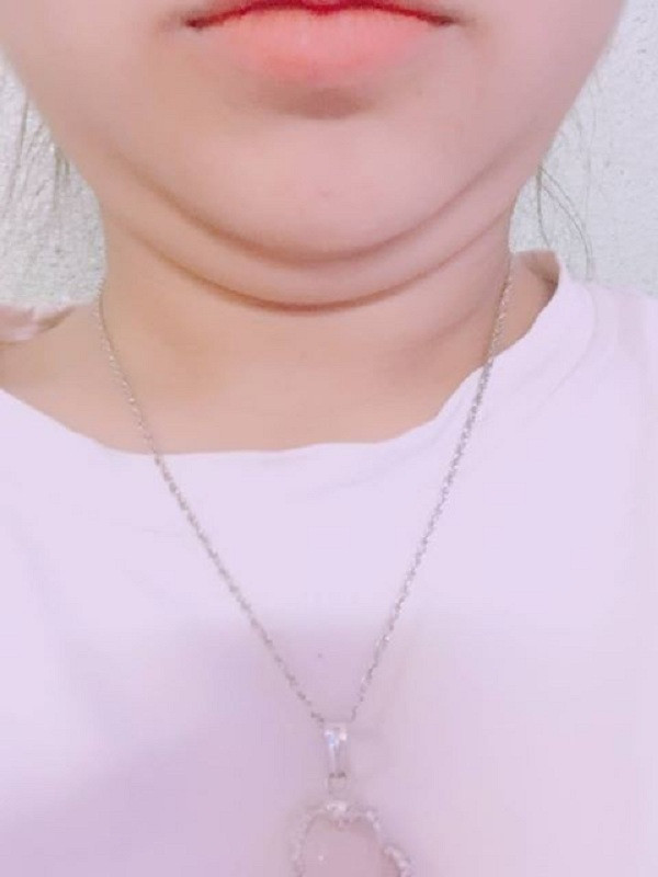 Theo nickname Nguyễn Thùy chia sẻ: "Ai bảo hai cằm là không xinh, mình cũng là con gái có khuôn mặt hai cằm nhưng vẫn đáng yêu hết phần thiên hạ đấy".