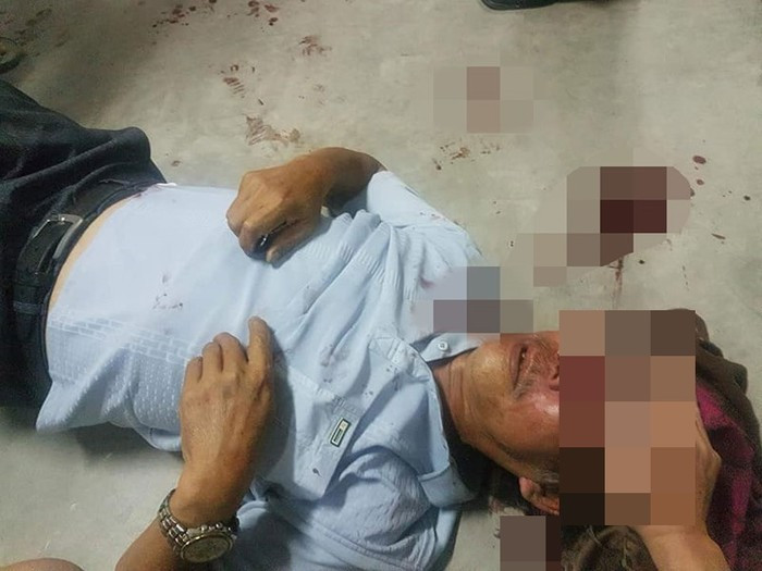 Kết quả, sau khi lãnh những pha "ra đòn" của chàng bảo vệ người đàn ông đứng tuổi đã phải nhập viện với thương tật là gãy sống mũi.