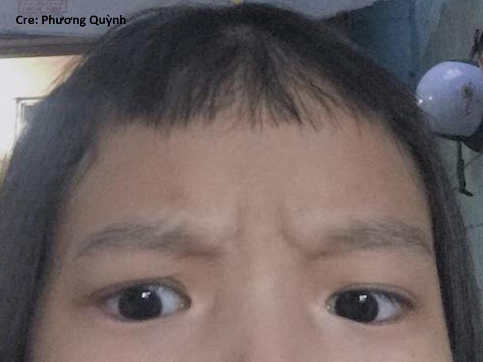 Tóc mái sợi dài sợi ngắn, nghiêng bên này lệch bên kia quả thật ngứa mắt và tiện cái kéo nhiều bạn trẻ đã tự xử luôn.