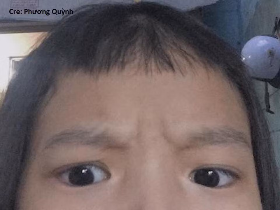 Tóc mái sợi dài sợi ngắn, nghiêng bên này lệch bên kia quả thật ngứa mắt và tiện cái kéo nhiều bạn trẻ đã tự xử luôn.