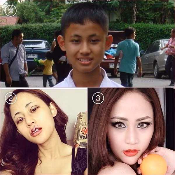 Trước đây, Namkleng chỉ là một cậu con trai thấp bé với làn da đen nhẻm nên thoạt nhìn, người ta dễ nhầm cô là một người theo phong cách tomboy bởi những đường nét khuôn mặt khá mềm và nhỏ nhắn.