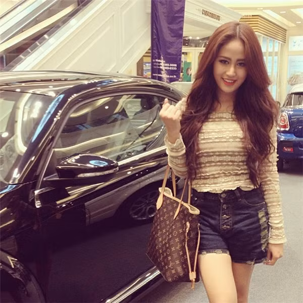 Cô không ngần ngại chia sẻ những bức ảnh chụp gương mặt mình khi vừa trải qua cuộc phẫu thuật với đôi mắt sưng húp, phần mũi và cằm băng bó và môi còn thâm tím.