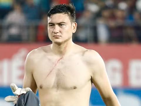 Bên cạnh đó, cũng có nhiều người cho rằng "không có lửa, sao có khói" bởi Sỹ Mạnh đang có một công việc rất thuận lợi, được nhiều đồng nghiệp nể trọng nhưng một phút thiếu kiềm chế lại hành hung Văn Lâm, một cầu thủ Việt kiều vốn có lối hành xử không giống ai. Ảnh: Zing.