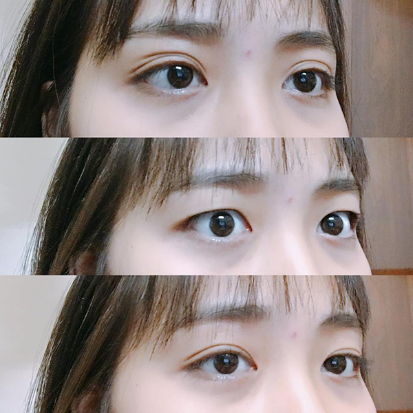 Những cô nàng một mí luôn phải đau đầu không biết làm cách nào để mắt to hơn, dù đã dùng nhiều cách như kích mí, kẻ mắt dày và đậm. Nhiều cô nàng còn muốn tìm đến các phương pháp làm đẹp mí mắt như nhấn mí, cắt mí để cải thiện đôi mắt nhỏ.