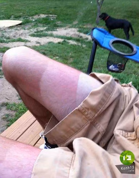 Bí quyết để có làn da 3 tông màu khác nhau đó là bôi kem chống nắng không đều.