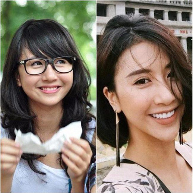 Quỳnh Anh Shyn đã không còn vẻ đẹp mộng mơ với khuôn mặt tròn xinh thuở còn đi học. Cô tân trang nhan sắc với mũi cao và cằm dài?