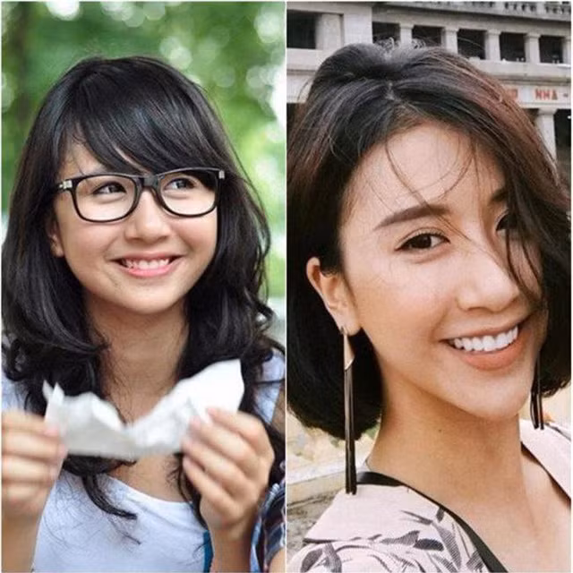 Quỳnh Anh Shyn đã không còn vẻ đẹp mộng mơ với khuôn mặt tròn xinh thuở còn đi học. Cô tân trang nhan sắc với mũi cao và cằm dài?