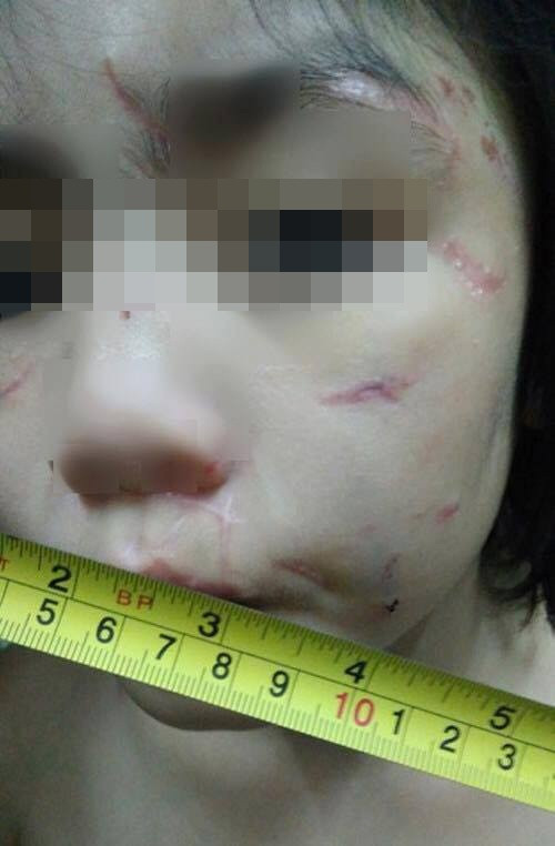 Đồng thuận với Mia Nguyễn, nickname Hoa Le bình luận với những ngôn từ khá mạnh: "Bỏ tù bọn này đi, đặc biệt là ông chồng. Đời thuở nhà ai, con ruột máu mủ của mình mà để cho con nặc nô khác hành hạ. Dù là yêu đến mấy thì yêu nhưng đã động đến con trai mình là chẳng có yêu thương gì hết. Hay ông này lại bị nó cho ăn bùa mê thuốc lú gì rồi. Thói đời khát máu tanh lòng mà".