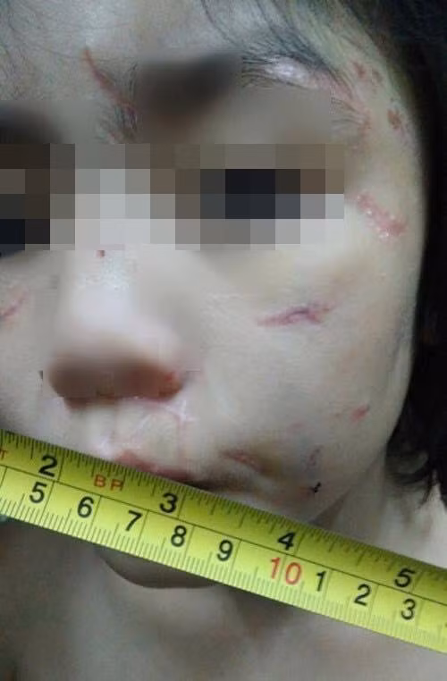 Đồng thuận với Mia Nguyễn, nickname Hoa Le bình luận với những ngôn từ khá mạnh: "Bỏ tù bọn này đi, đặc biệt là ông chồng. Đời thuở nhà ai, con ruột máu mủ của mình mà để cho con nặc nô khác hành hạ. Dù là yêu đến mấy thì yêu nhưng đã động đến con trai mình là chẳng có yêu thương gì hết. Hay ông này lại bị nó cho ăn bùa mê thuốc lú gì rồi. Thói đời khát máu tanh lòng mà".