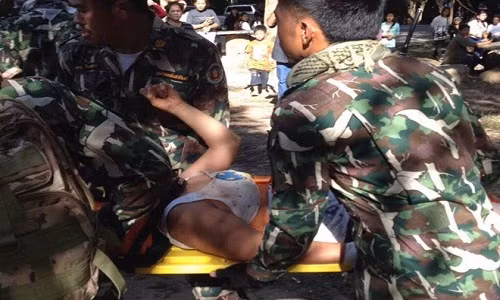 Du khách bị cá sấu cắn vì chụp ảnh quá gần (ca trực) Du khach bi ca sau can vi chup anh qua gan (ca truc)