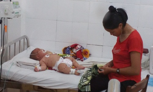 Phat hien benh nhi nghi nhiem viem mang nao mo cau o Dak Lak-Hinh-2