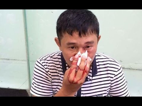 Chưa dừng lại ở đó, vị khách kia còn cầm vợt tennis chạy theo vụt tới tấp vào tay và mũi của anh chàng ship hàng. Thế mới biết, nghề shipper cũng chứa đựng bao nỗi nhọc nhằn.