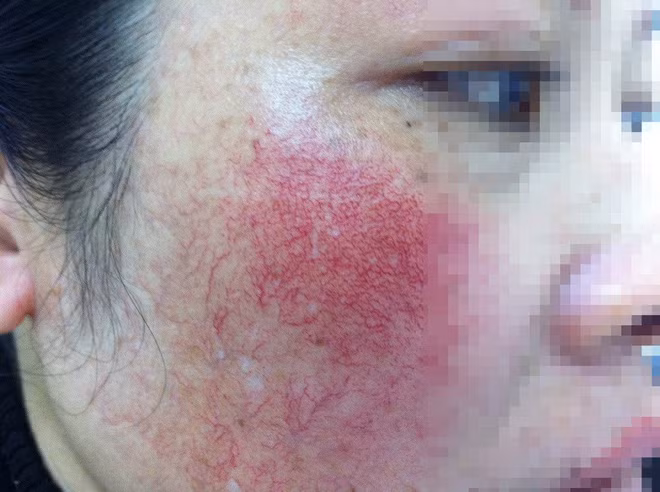 Theo chia sẻ của nickname Hoàng Mỹ Anh cho biết: "Với người phụ nữ nhan sắc là điều quý giá, mình quan niệm rõ ràng về điều đó nên thường xuyên chọn những mỹ phẩm có nguồn gốc xuất xứ rõ ràng. Biết rằng dẫu đắt hơn nhưng đã được kiểm nghiệm và an toàn thì người ta mới bán. Chứ dùng mấy loại kem trộn hay tắm trắng tự pha sợ lắm. Bao nhiêu gương rồi mà các mẹ chưa "tởn" sao?".