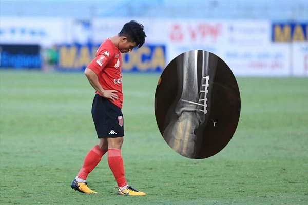 Tấn Tài là gương mặt không còn xa lạ gì với những pha vào bóng triệt hạ đối phương ở các sân chơi bóng đá Việt Nam. Cầu thủ này thi đấu năng nổ nhưng cũng không ít lần khiến người xem cảm giác hơi rợn người với những pha vào bóng kiểu đánh võ của mình.