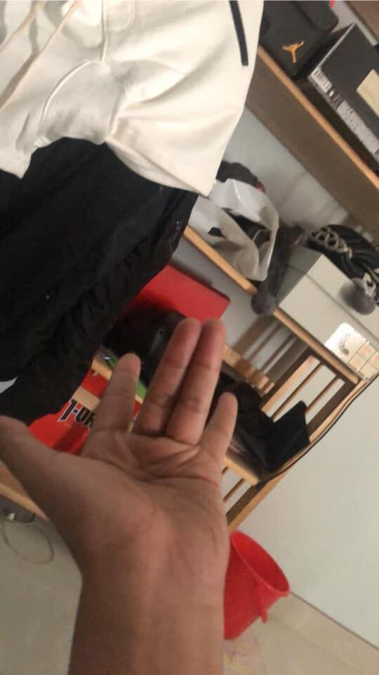 Dù đã cố gắng rất nhiều nhưng 2 ngón tay vẫn không thể chạm vào nhau.