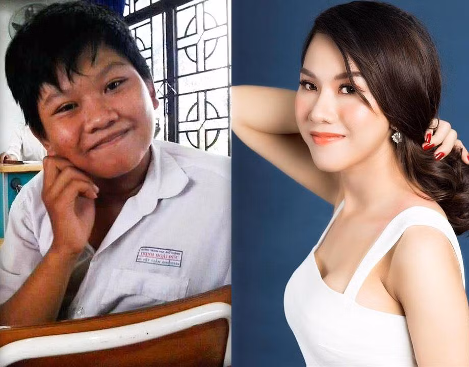 1 tháng sau các cuộc phẫu thuật, Ngọc Anh mới bắt đầu hồi phục và sinh hoạt bình thường.