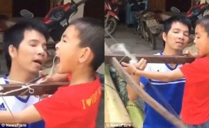 Mới đây, các trang tin lớn trên thế giới trong đó có Daily Mail vừa đăng tải đoạn clip màn nhổ răng bằng nỏ cực thú vị này của hai bố con người Việt khiến ai xem cũng phải ôm bụng cười.