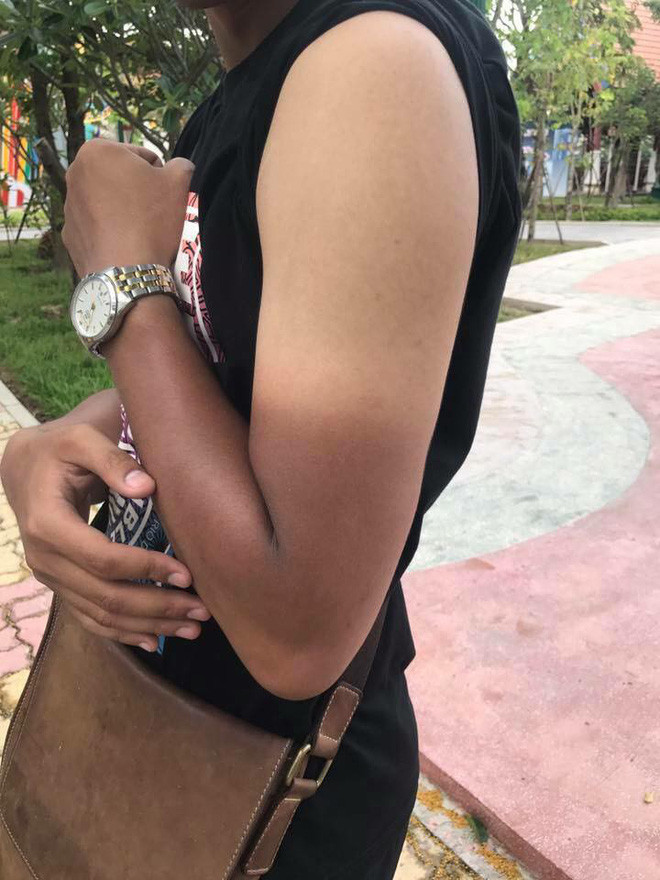 Những ngày trắng trẻo lùi xa vào quá khứ và thay vào đó là làn da đen đúa, cháy nắng của mùa hè oi ả.