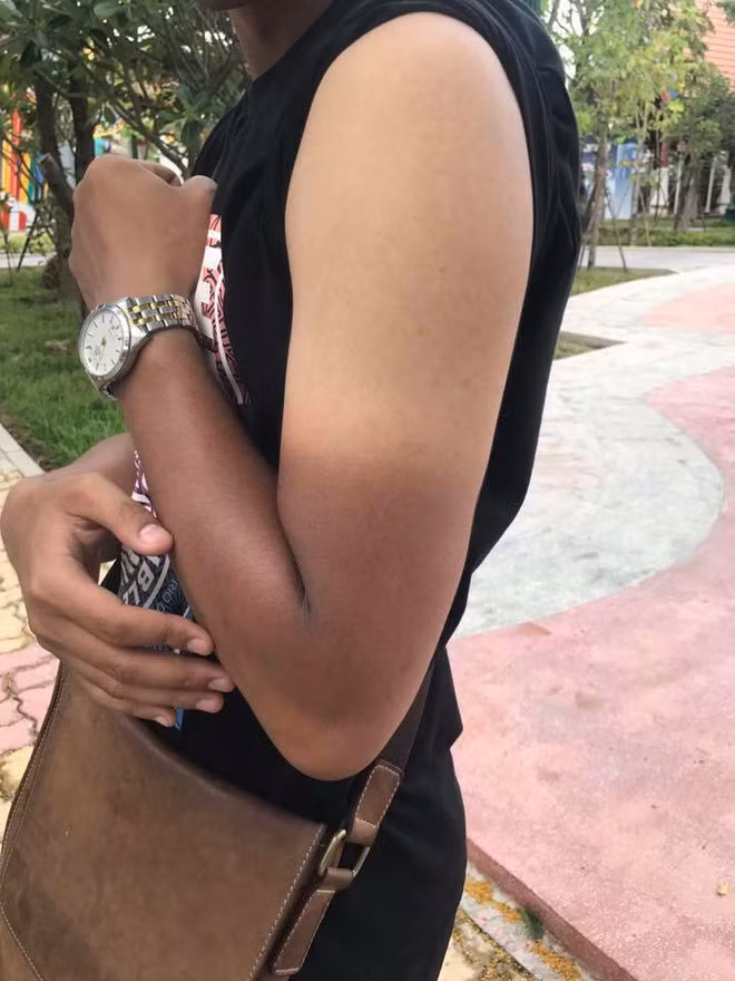 Những ngày trắng trẻo lùi xa vào quá khứ và thay vào đó là làn da đen đúa, cháy nắng của mùa hè oi ả.