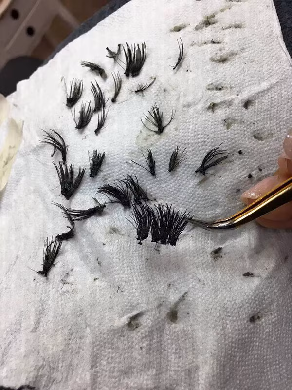 Khi được tháo ra, từng đoạn mi giả dày, vón bong thành từng mảng và kéo theo gần hết lông mi thật, chỉ để lại phần chân mi trơ trụi trên mắt.