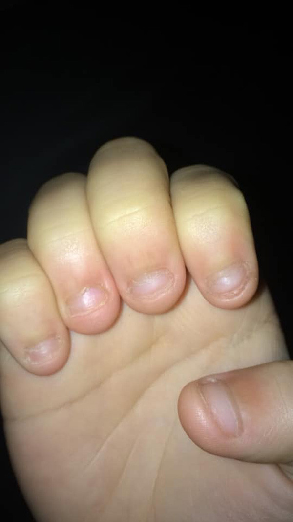 Thế nhưng mặt kém sắc có thể trang điểm hoặc phẫu thuật thẩm mỹ, tóc xấu có thể đầu tư tiền bạc để 'trùng tu', còn không may mắn sở hữu bàn tay xấu xí và bộ móng cụt lủn thì các cô nàng không thể chữa được.