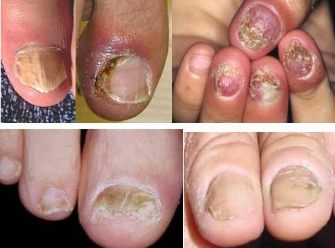 Dù vì bất kỳ lý do nào thì nỗi khổ mà "team tay xấu" phải chịu là điều hoàn toàn dễ thấy.