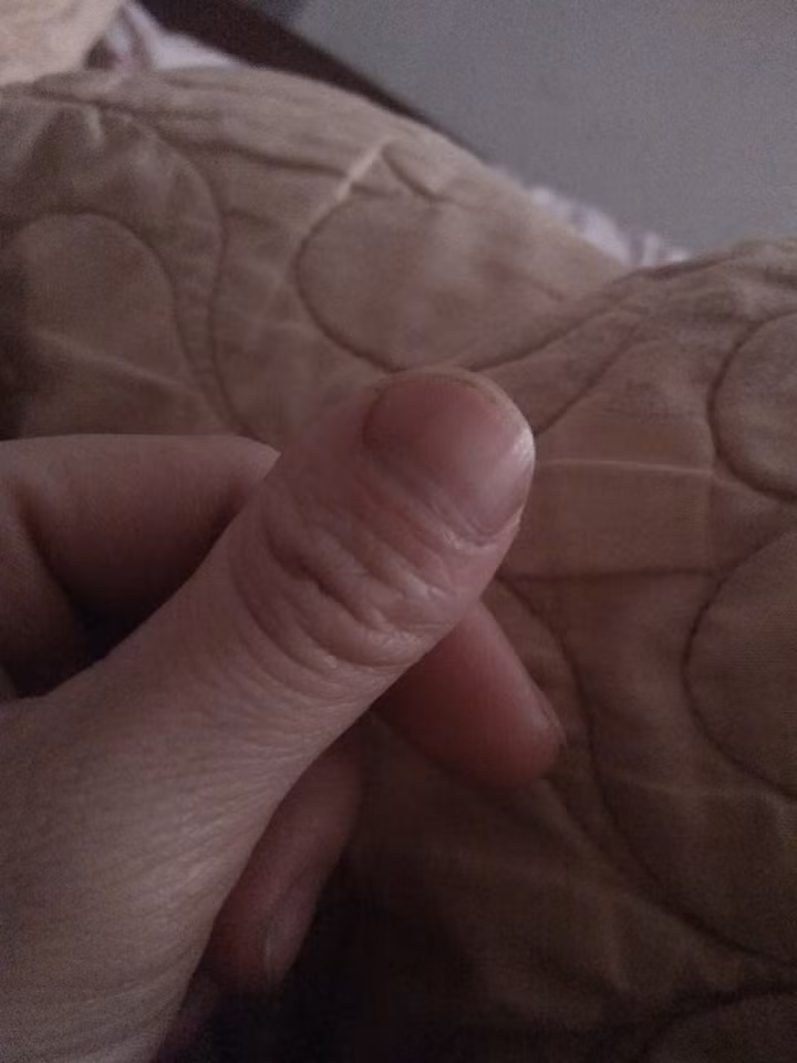 Cả bàn tay đẹp trừ ngón cái.