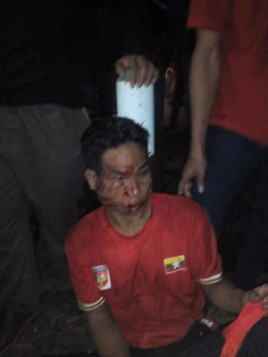 CĐV Malaysia được vốn là những "kẻ" chẳng hiền lành, không chỉ đánh các CĐV Việt Nam tại AFF 2014 trên sân Shah Alam, mới đây họ còn "ra tay" với CĐV Myanmar trong trận đấu tại vòng bảng môn bóng đá nam SEA Games diễn ra tối 21/8. ẢNh: Facebook