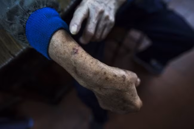 Ông Mak làm việc tại Cửa hàng She Wong Lam từ lúc 15 tuổi. Ông bị rắn cắn vô số lần, nhưng chưa lần nào bị rắn độc tấn công.