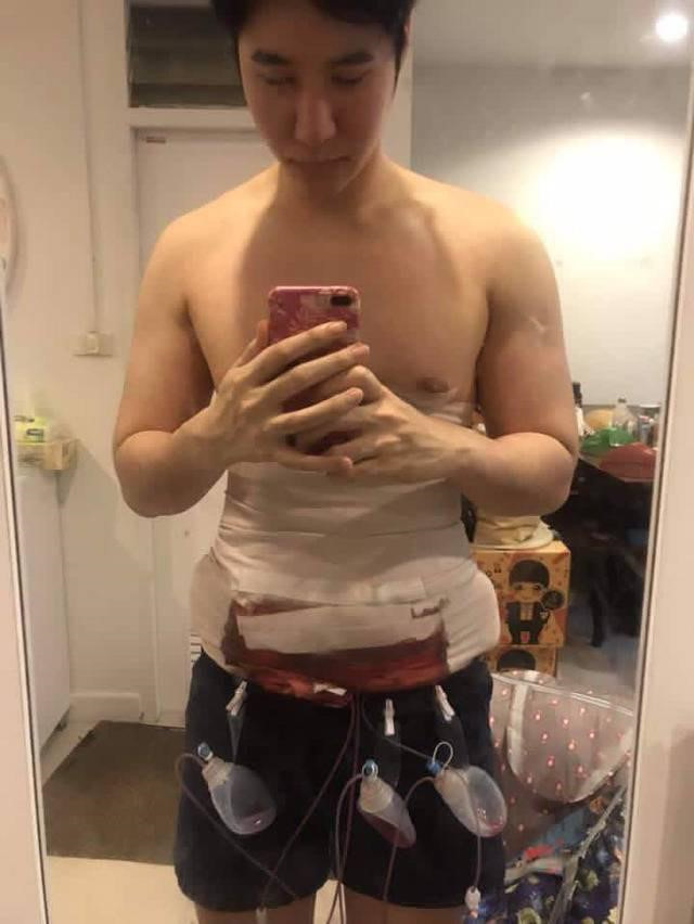 Theo báo giới tại Hàn Quốc và Thái Lan, thời gian qua, rất nhiều chàng trai cho rằng các phương pháp phẫu thuật thẩm mỹ để cơ thể đẹp hơn.