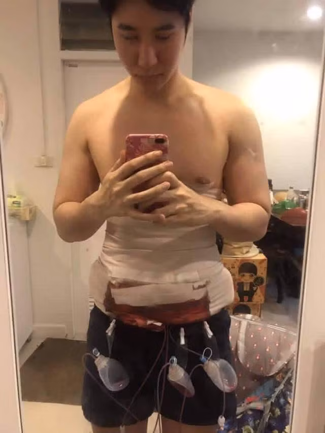 Theo báo giới tại Hàn Quốc và Thái Lan, thời gian qua, rất nhiều chàng trai cho rằng các phương pháp phẫu thuật thẩm mỹ để cơ thể đẹp hơn.